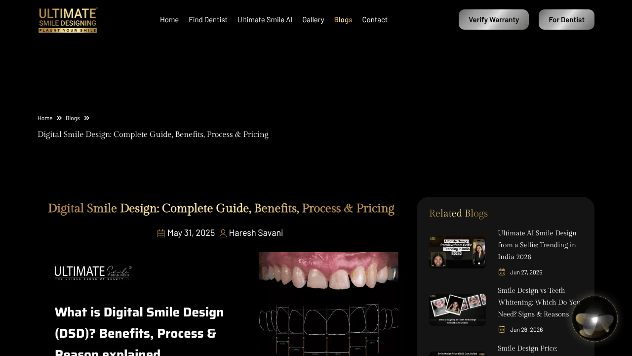 Ultimate Smile Design website screenshot